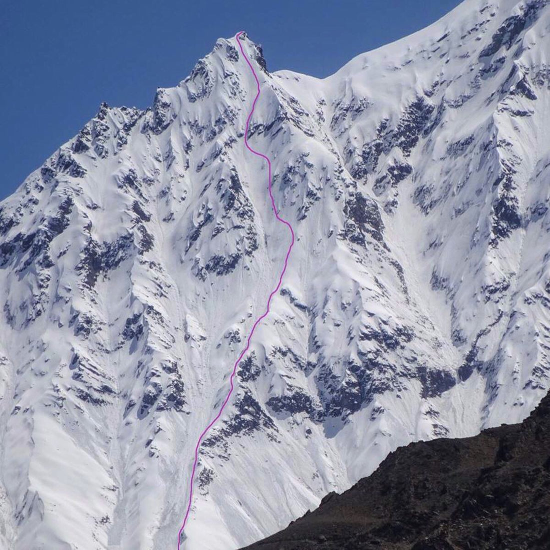 Surviving Avalanches, Huge Falls, Broken Spines, and Insurance Companies